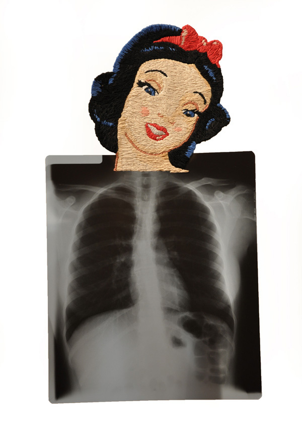 Heartthrob #1, Snow White, 14 x 24 1/2", 2011, Hand-embroidered x-ray.