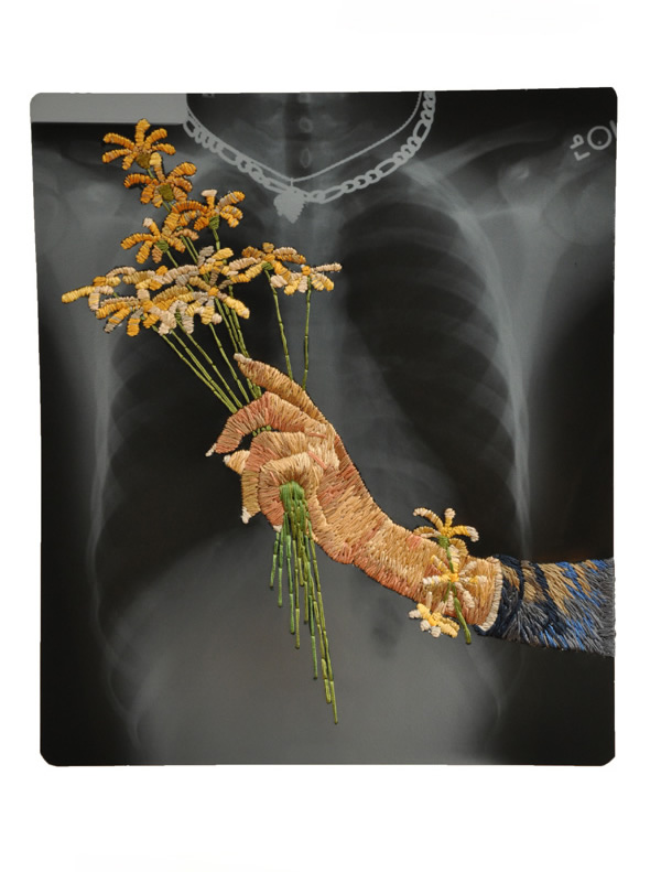 Daisy Bracelet, 14 x 17", 2012, Hand-embroidered x-ray.