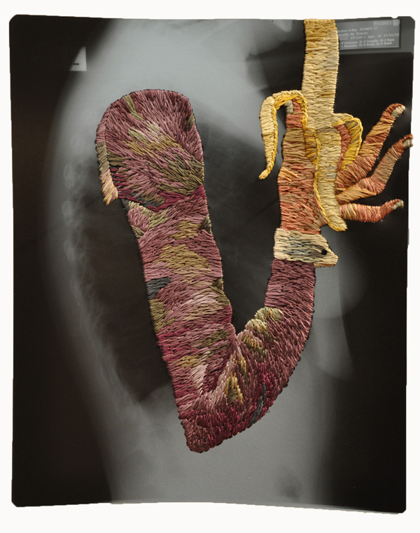 Banana, 14 x 17", 2010, Hand-embroidered x-ray.