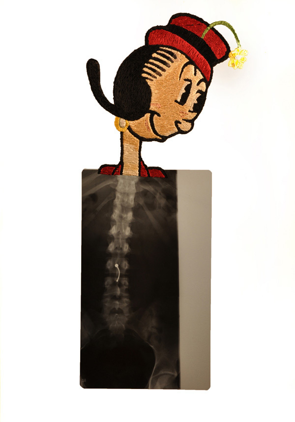 Heartthrob #4, Olive Oyl, 12 1/2 x 28 1/2", 2011, Hand-embroidered x-ray.